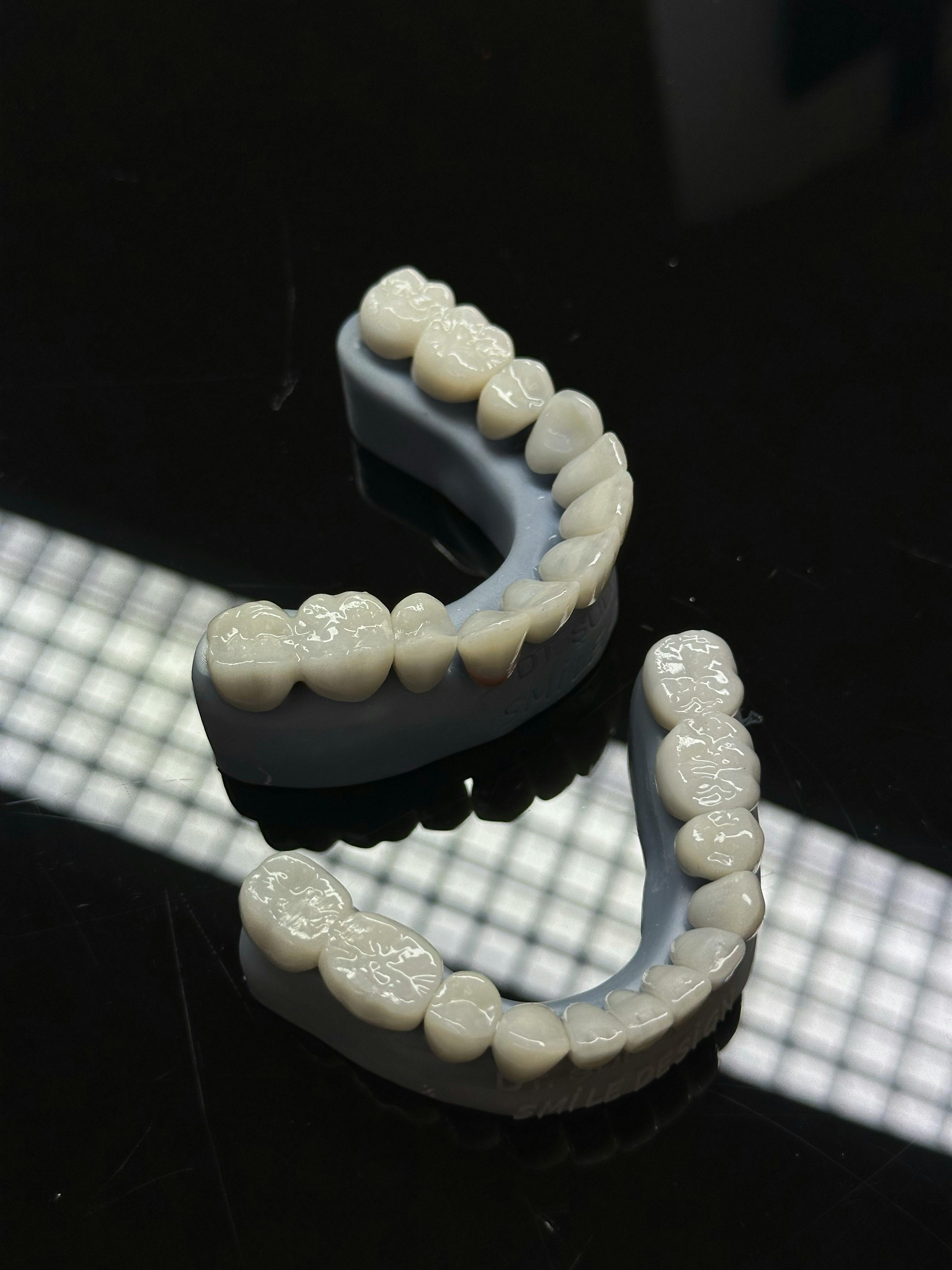 Close-up high-definition view of a dental crown during glazing